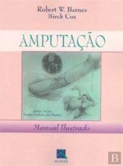 Bertrand.pt - Amputação