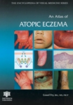 Bertrand.pt - An Atlas Of Atopic Eczema