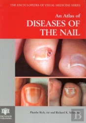 An Atlas Of Diseases Of The Nail