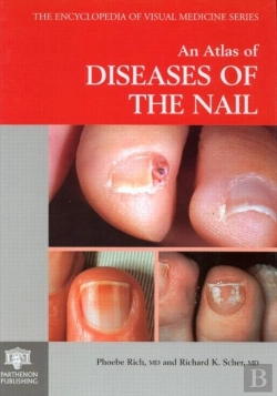 Bertrand.pt - An Atlas Of Diseases Of The Nail