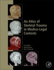 An Atlas Of Skeletal Trauma In Medico-Legal Contexts