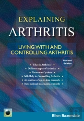 An Emerald Guide To Explaining Arthritis