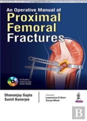 An Operative Manual Of Proximal Femoral Fractures