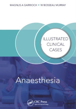 Bertrand.pt - Anaesthesia