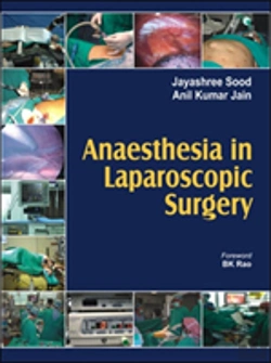 Bertrand.pt - Anaesthesia In Laparoscopic Surgery