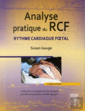 Analyse Pratique Du Rcf ; Rythme Cardaique Foetal (2e Édition)
