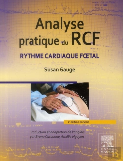Bertrand.pt - Analyse Pratique Du Rcf ; Rythme Cardaique Foetal (2e Édition)