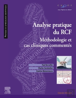Bertrand.pt - Analyse Pratique  Du Rcf : Rythme Cardiaque Foetal