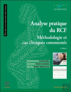 Bertrand.pt - Analyse Pratique Du Rcf : Rythme Cardiaque Fœtal