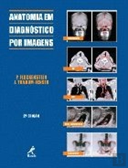 Bertrand.pt - Anatomia em Diagnóstico por Imagens