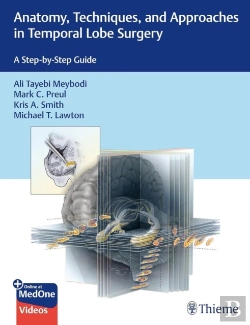 Bertrand.pt - Anatomy, Techniques, And Approaches In Temporal Lobe Surgery