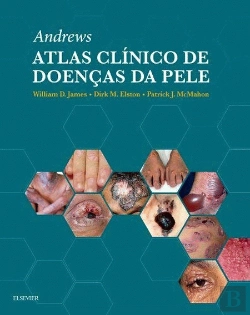 Bertrand.pt - Andrew - Atlas Clínico de Doenças da Pele