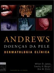 Andrews - Doenças da Pele