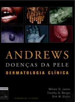 Bertrand.pt - Andrews - Doenças da Pele