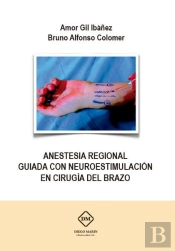 Anestesia Regional Guiada Con Neuroestimulacion En Cirugia Del Brazo