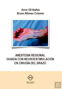Bertrand.pt - Anestesia Regional Guiada Con Neuroestimulacion En Cirugia Del Brazo