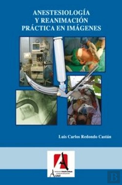 Bertrand.pt - Anestesiología Y Reanimación Práctica En Imágenes