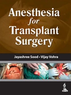 Bertrand.pt - Anesthesia For Transplant Surgery