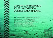 Aneurisma De Aorta Abdominal