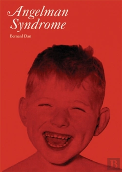 Bertrand.pt - Angelman Syndrome