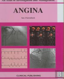 Angina