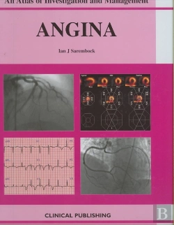 Bertrand.pt - Angina