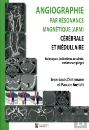 Angiographie Par Resonance Magnetique (Arm) Cerebrale Et Medullaire