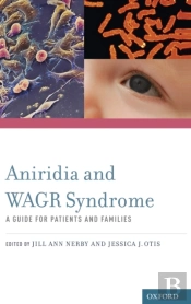 Aniridia And Wagr Syndrome