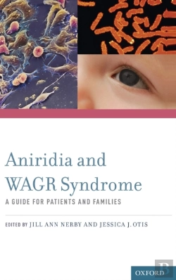 Bertrand.pt - Aniridia And Wagr Syndrome