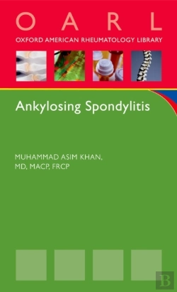 Bertrand.pt - Ankylosing Spondylitis
