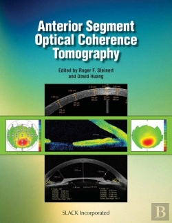 Bertrand.pt - Anterior Segment Optical Coherence Tomography