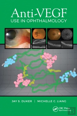 Bertrand.pt - Anti-Vegf Use In Ophthalmology