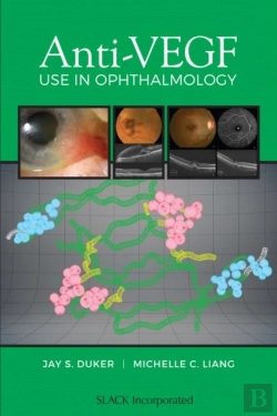 Bertrand.pt - Anti-Vegf Use In Ophthalmology