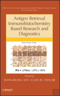 Bertrand.pt - Antigen Retrieval Immunohistochemistry Based Research And Diagnostics