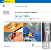 Ao Manual Of Fracture Management: Internal Fixators