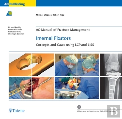 Bertrand.pt - Ao Manual Of Fracture Management: Internal Fixators