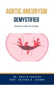 Aortic Aneurysm Demystified: Doctor'S Secret Guide