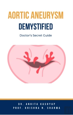 Bertrand.pt - Aortic Aneurysm Demystified: Doctor'S Secret Guide
