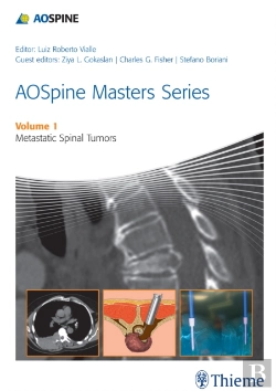 Bertrand.pt - Aospine Masters Series Volume 1: Metastatic Spinal Tumors