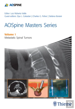 Bertrand.pt - Aospine Masters Series, Volume 1: Metastatic Spinal Tumors