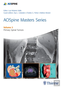 Bertrand.pt - Aospine Masters Series, Volume 2: Primary Spinal Tumors