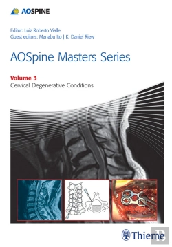 Bertrand.pt - Aospine Masters Series, Volume 3: Cervical Degenerative Conditions