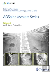 Aospine Masters Series, Volume 4: Adult Spinal Deformities