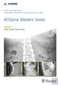 Bertrand.pt - Aospine Masters Series, Volume 4: Adult Spinal Deformities