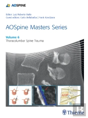 Aospine Masters Series, Volume 6: Thoracolumbar Spine Trauma