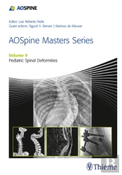 Aospine Masters Series, Volume 9: Pediatric Spinal Deformities