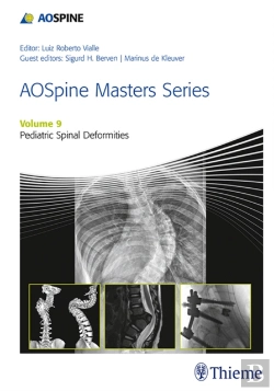 Bertrand.pt - Aospine Masters Series, Volume 9: Pediatric Spinal Deformities