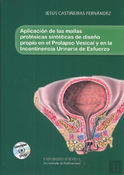Bertrand.pt - Aplicación De Las Mallas Protésicas Sintéticas De Diseño Propio En El Prolapso Vesical Y En La Incon