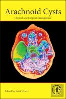 Arachnoid Cysts
