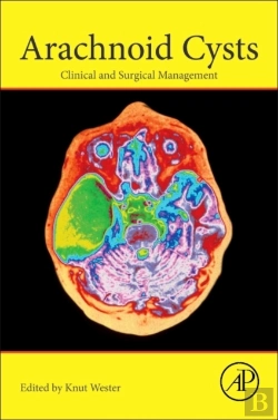 Bertrand.pt - Arachnoid Cysts